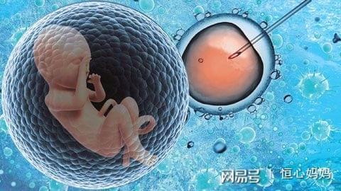 专家